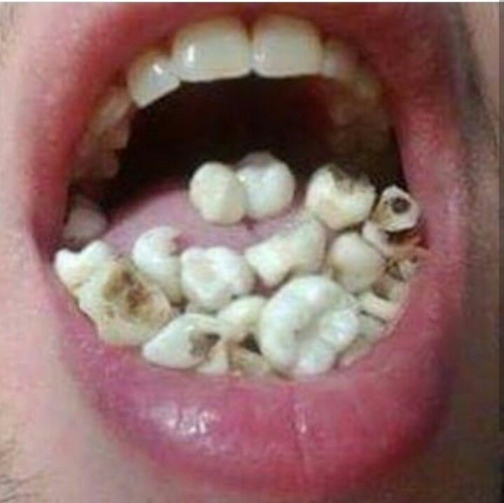 full
